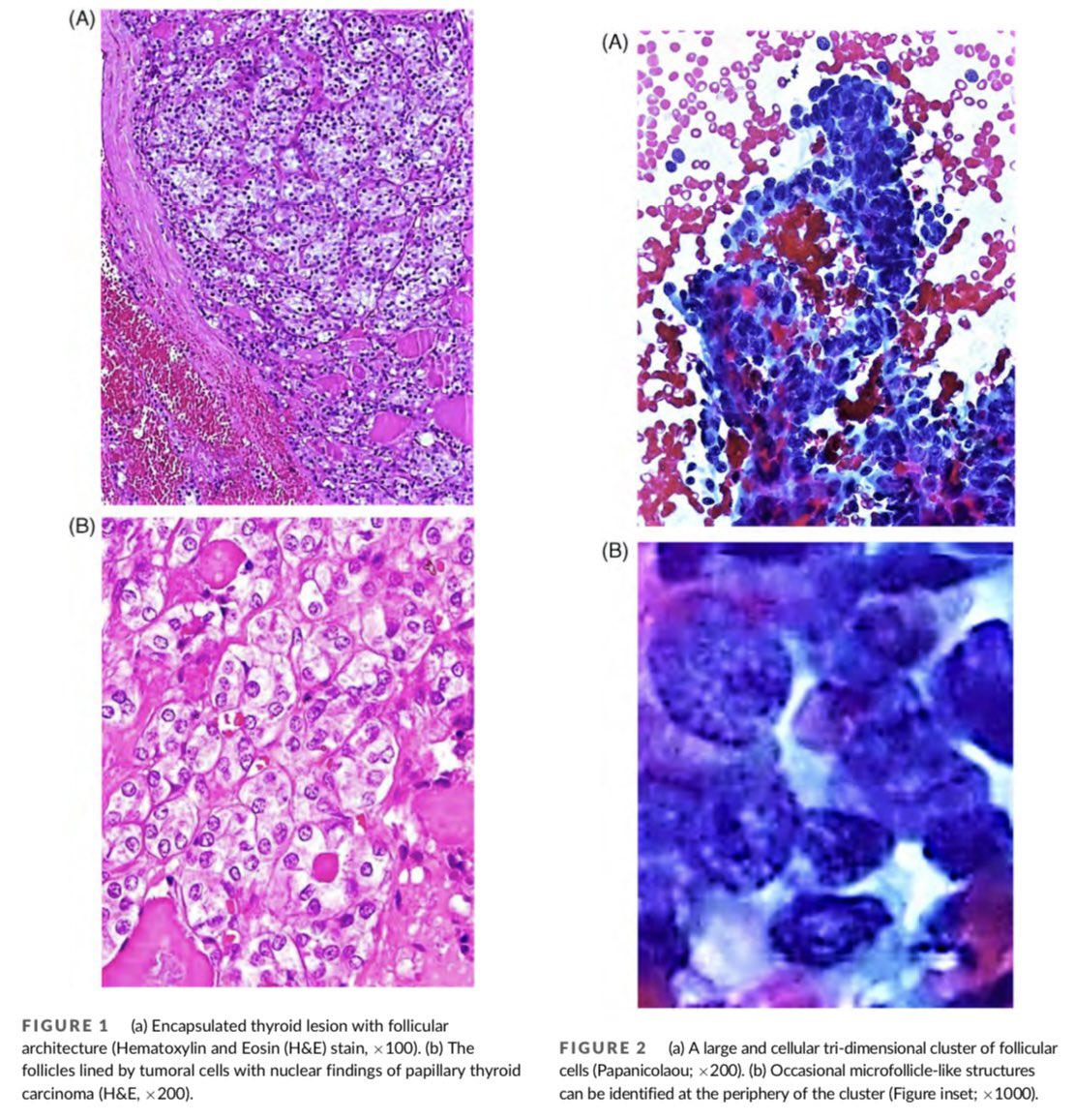 DiagnosticCyto tweet picture