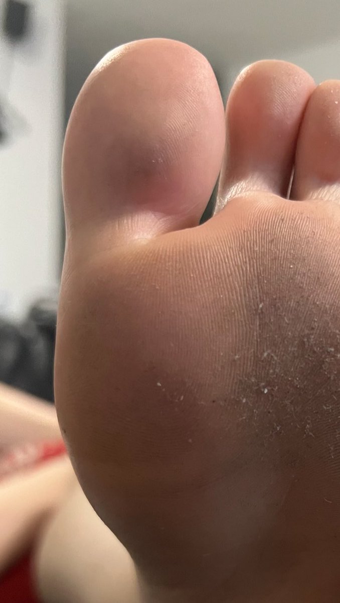 feetsarahnyc's tweet photo. Who wants to lick??? 

https://t.co/4rbIWeFXjc https://t.co/Q0oiEENJIH