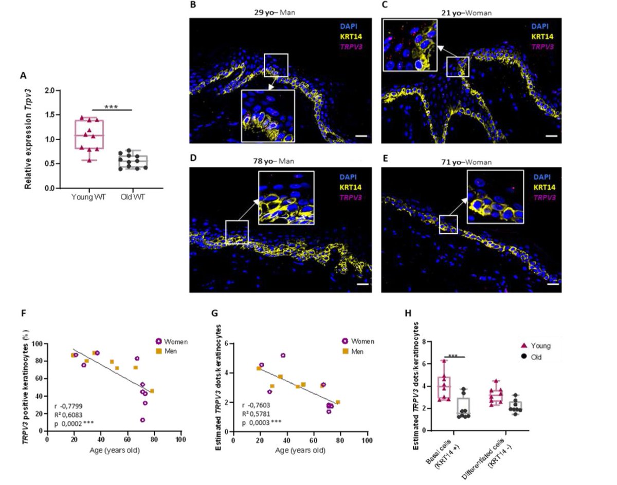 📢New in GeroScience
Aging is associated with impaired triggering of TRPV3-mediated cutaneous vasodilation: a crucial process for local heat exposure.
link.springer.com/article/10.100…
#trpv3 #keratinocytes #vasodilation #Aging <a href="/GroupSkin/">Skin Functional Integrity Group</a>