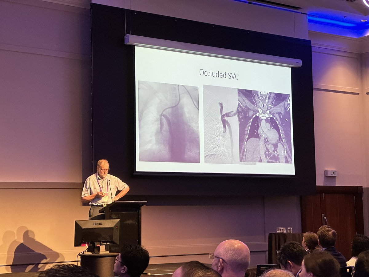 @ANZSN #APSDA Cairns, Australia 2023. Interventional Nephrologist, Dr Steve May, talks about Hemodialysis Catheter insertions, and troubleshooting when things go wrong. Invaluable experience and wisdom.