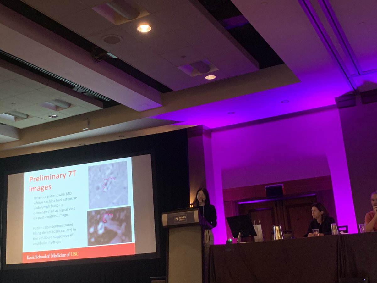 Rajagopalan_Pri's tweet photo. @janineschan from @KECKSchool_USC expertly discusses feasibility of #7Tesla #MR imaging of #Meniere’s disease #hydrops #wnrs23 #neurorad @RadiologyUSC @wnrs2023 @USCLONI https://t.co/UpGu56f9Tj