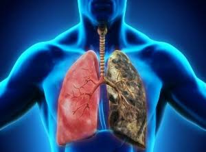 navipeth's tweet photo. @TOIMumbai #AirPollution causes
#NonReversible

#Asthma #TB #Cancer #Bronchitis

It's like ok passively smoking 1000s of
beedi at a time

@worldgreendlp
@WHO @WBG_Climate @UNEP @FT @nytimes @WSJ @BBCNews @cnnbrk https://t.co/MMiqmxlgjE