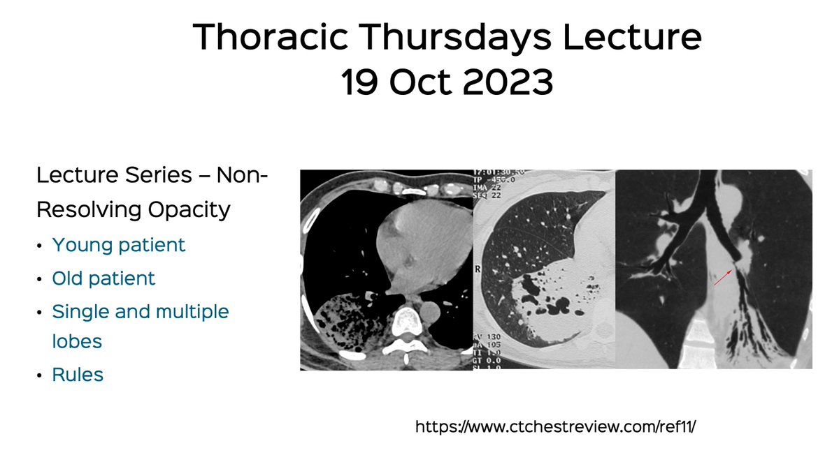 REF-Cafe Roentgen Thoracic Thursdays - XI: Non-Resolving Opacity

Lecture Video
ctchestreview.com/ref11/

#ref #caferoentgen #chestrad #ctchest #FOAMrad #radres #nonresolvingopacity