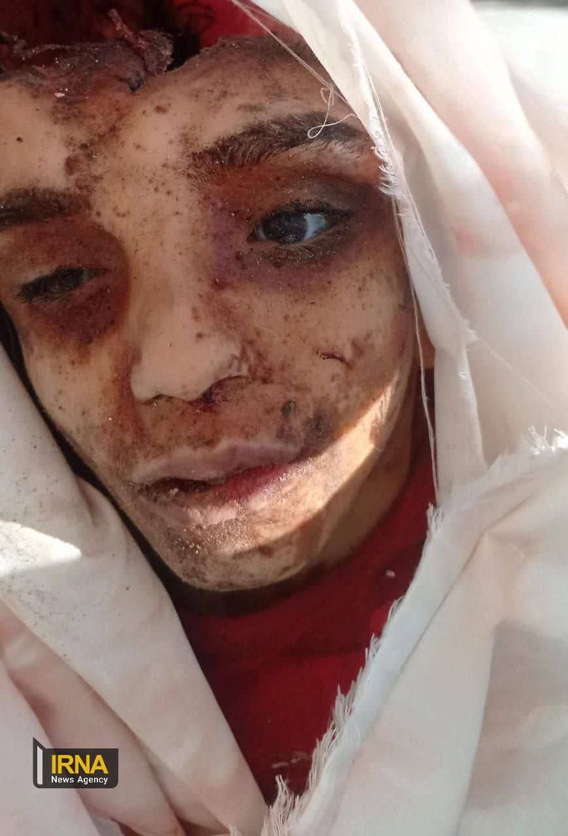 heidari_z's tweet photo. @bbcpersian کودک کشی اسرائیل پشت نقاب حمله به حماس
#Gaza https://t.co/jythsQuqUI