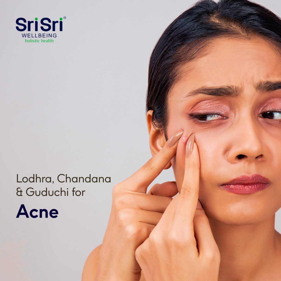 Don't let acne hold you back! Lodhra, Chandana, and Guduchi are your secret weapons for spotless skin.  #Ayurvedaskincare #Acnesolution #SundaySelfcare #SriSriWellbeing