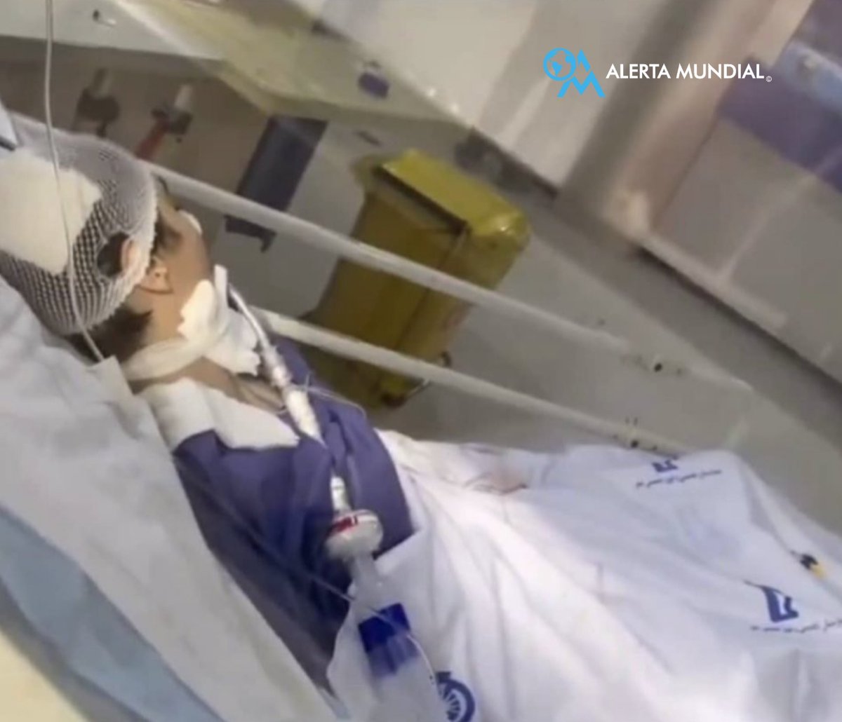 AlertaMundoNews's tweet photo. 🇮🇷 | ATENCIÓN: La joven de 16 años Armita Geravand ha sido declarada en "estado de muerte cerebral" tras sufrir una agresión a manos de la policía de la moralidad iraní por no llevar puesto el hiyab. https://t.co/T75bbHQVk7
