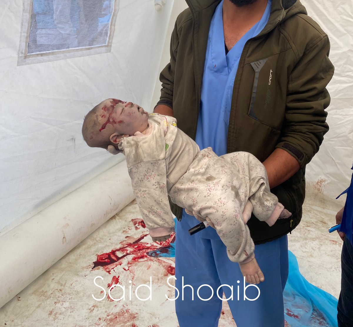 saidshoaib_gaza's tweet photo. What did she do to deserve this?

#Gaza https://t.co/3FSkbJsa4a