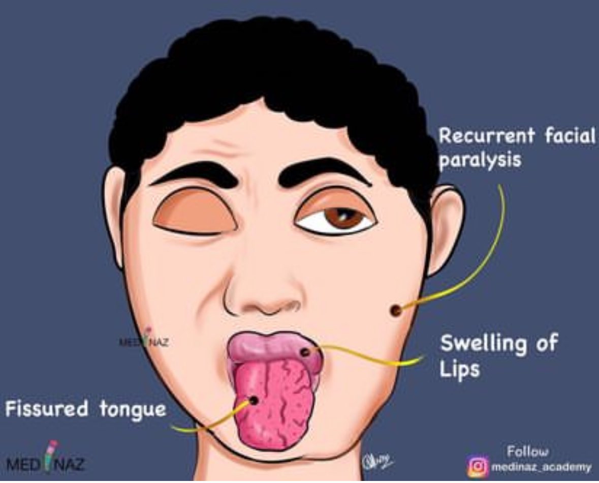 BrownJHM's tweet photo. Diagnosis? #medEd (Medinaz Academy) https://t.co/AJvtpkETSa