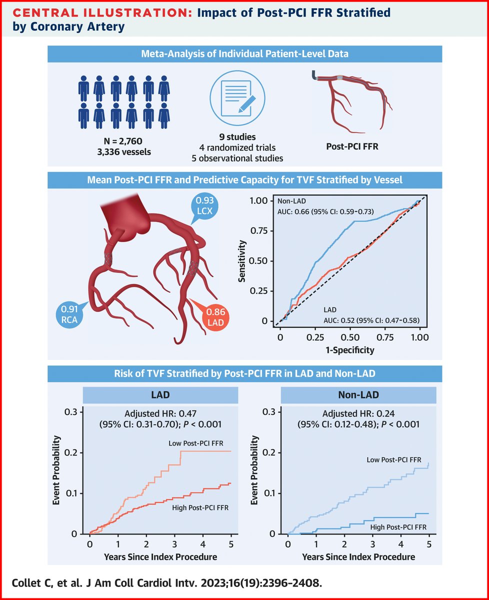 JACC Journals (@jaccjournals) on Twitter photo LAD is associated with a lower post-PCI FFR than non-LAD arteries, emphasizing the importance of interpreting post-PCI FFR on a vessel-specific basis. bit.ly/3M8YqtC
#JACCINT #PCI #FFR #CardioTwitter #cvCAD <a href="/ColletCarlos/">Carlos Collet MD PhD</a> LAD is associated with a lower post-PCI FFR than non-LAD arteries, emphasizing the importance of interpreting post-PCI FFR on a vessel-specific basis. bit.ly/3M8YqtC
#JACCINT #PCI #FFR #CardioTwitter #cvCAD <a href="/ColletCarlos/">Carlos Collet MD PhD</a>