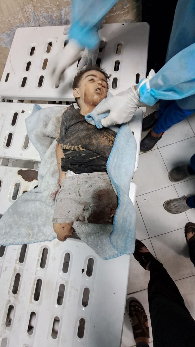 EnglishGaza's tweet image. A child is now arriving in dismembered pieces at the Indonesian Hospital in the northern Gaza Strip as a result of the ongoing bombing.