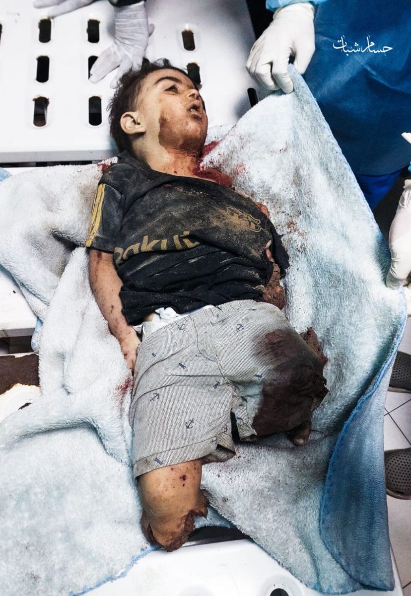 EnglishGaza's tweet image. A child is now arriving in dismembered pieces at the Indonesian Hospital in the northern Gaza Strip as a result of the ongoing bombing.