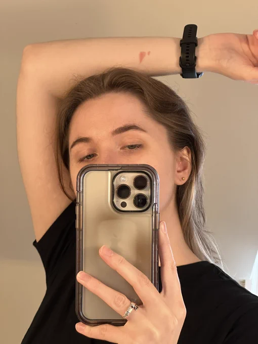 I accidentally burned my arm on the heat gun at work the other day and now every time I look at it I hear the Metal Gear Solid alert noise in my head 