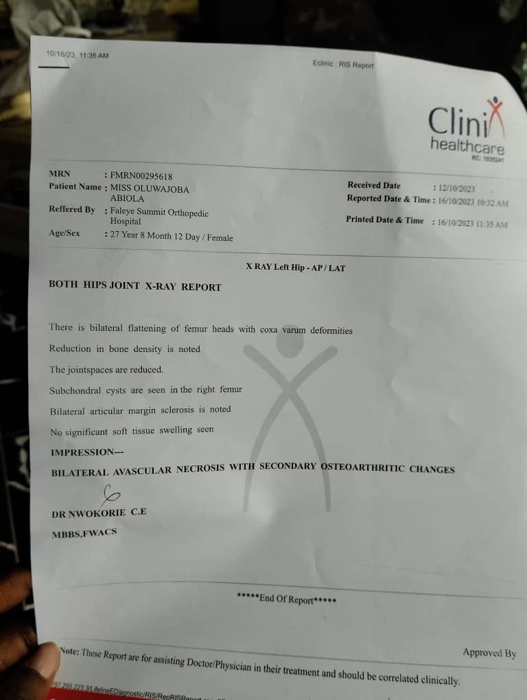 OsunTwitta's tweet image. One of us @oluwajobabiola needs our help.

Abiola Deborah, OLUWAJOBA who is suffering from  bilateral avascular necrosis, complication of sickle cell anaemia is hoping to raise a sum of #8m for a total bilateral hip replacement at Summit Orthopedic Hospital, Lagos.