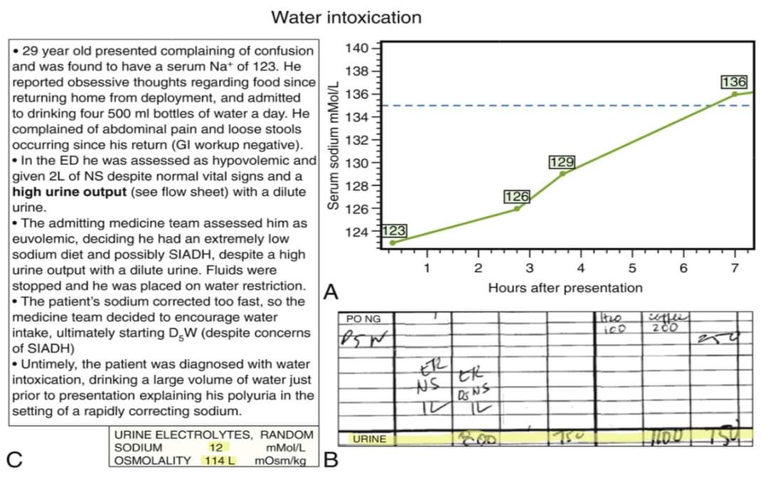 LandsbergManual's tweet photo. Better #hyponatremia Algorithm:
Must consider Urine Output, essential for identifying #Waterintoxication and ARF as the etiol.
#Medtwitter #kidney #meded #hospitalist #CardioTwitter #Nephrology #heartfailure #pulmonary #critcalcare #Anesthesia @ArgaizR #internalmedicine PRTIYL https://t.co/67a7GGTf1M