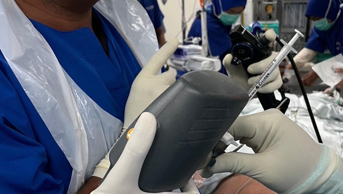 ArvinAlaga's tweet photo. #IP
#CHESTAlorSetar
#BTVA
Bronchoscopic Thermal Vapor Ablation(BTVA) treatment for severe emphysema was successfully performed in CHEST Alor Setar on 18/10/2023. https://t.co/hjPln2ukkj