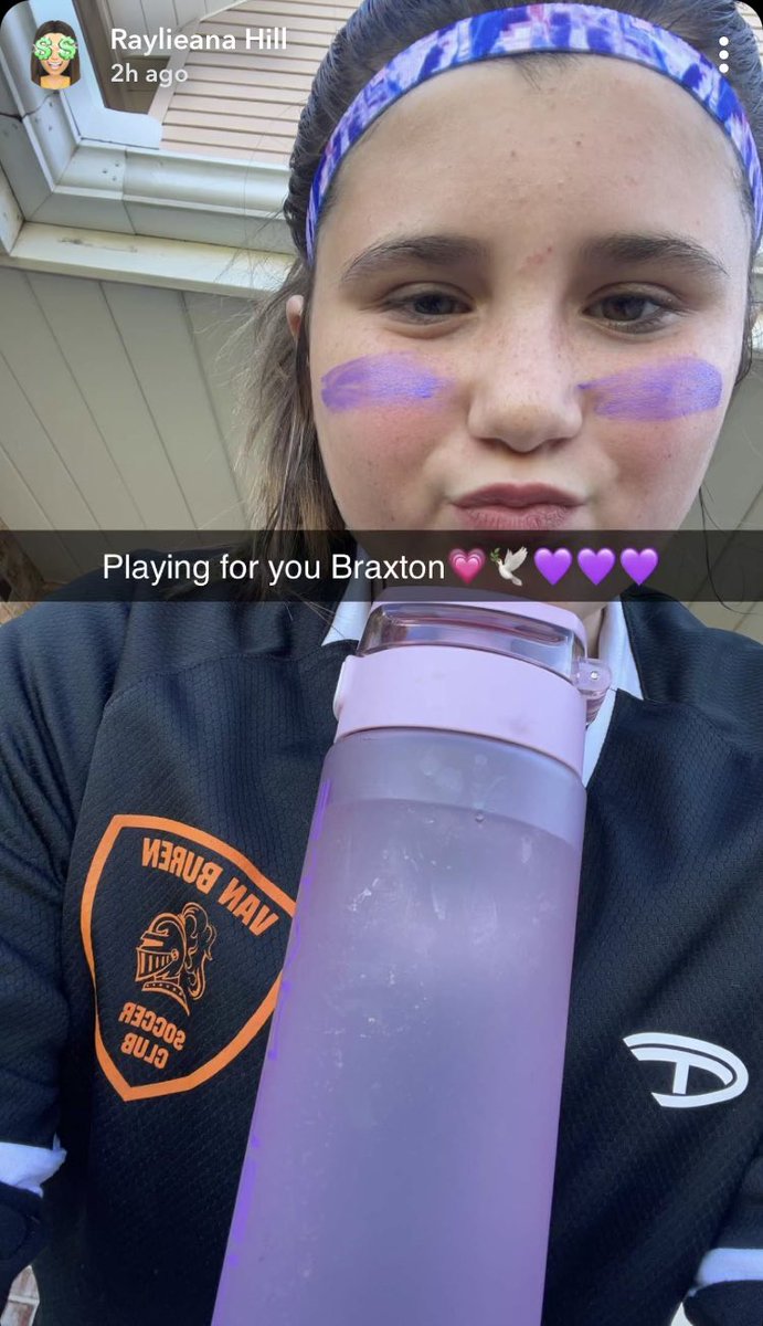 The entire team wore purple. 💜 #Epilepsy #UBA5 #Childloss