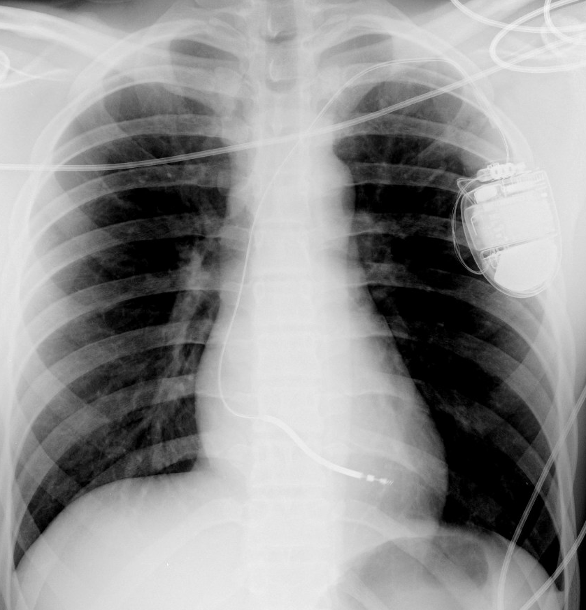 Jeffrey M Vinocur tweet media