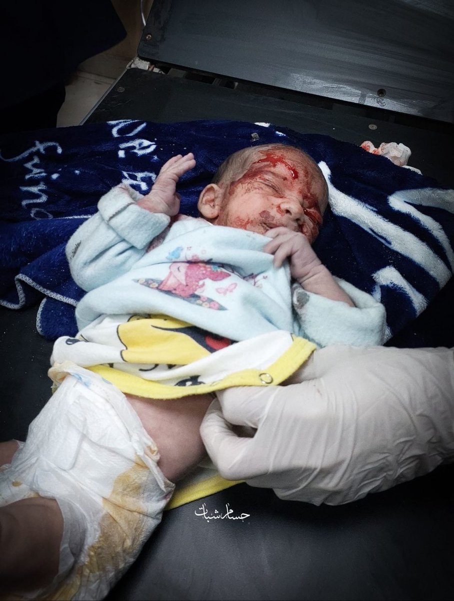 EnglishGaza's tweet photo. With the support of the following governments: #America 🇺🇸, #France 🇫🇷, #Germany 🇩🇪, #Italy and #Britain 🇬🇧 after giving the green light to kill #Palestinian 🇵🇸 civilians in #Gaza.
“The #Israeli occupation kills dozens of children in just the last 3 hours.” https://t.co/aV1qD3aCbS