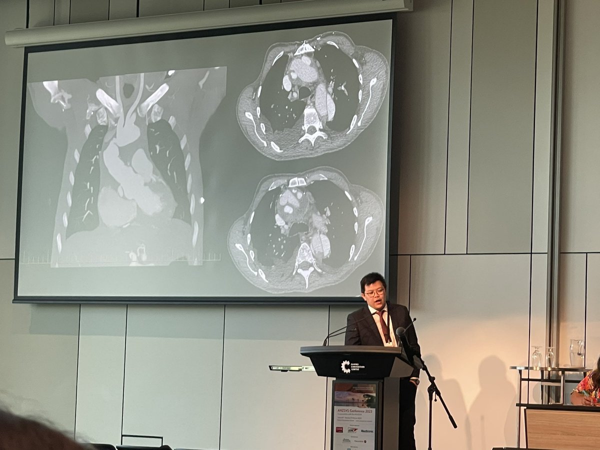 WaikatoVascular's tweet photo. Many high quality cases presented today at the #ANZSVS23 “Challenge the Experts” with excellent discussion from the panellists. Shoutout to Drs Tom Cavaye and Eric Lim from Waikato
@drmarkjjackson @ShereneShalhub @PeckyDeSilva @Jonnyboyle1 @CenterAortic @EricLim252 https://t.co/PCqeeN7IAR