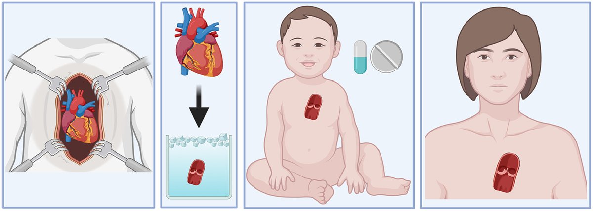 Partial #HeartTransplantation: Growing #HeartValveImplants for children
👉tinyurl.com/3p2h9m47
@Archildrens #CongenitalHeartSurgery #ExperimentalSurgery