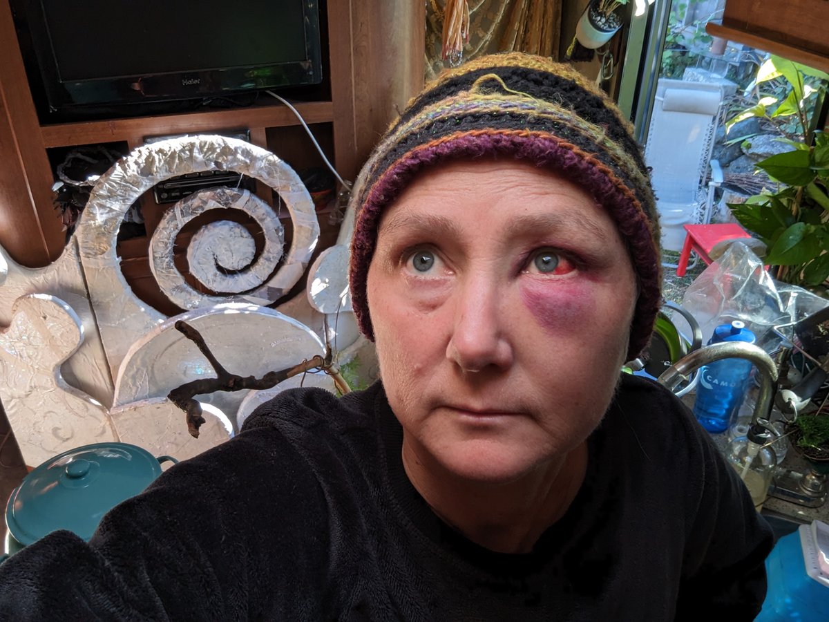 MeghanEMurphy's tweet photo. A trans activist punched a 52 year old woman at the #1MillionMarch4Kids in Nanaimo yesterday. These are the 'no space for hate' people. These are the Canadians claiming *we* are hateful. These violent psychos. Get it straight @Dave_Eby @bcndp @JustinTrudeau  https://t.co/5qrRL7hyFt