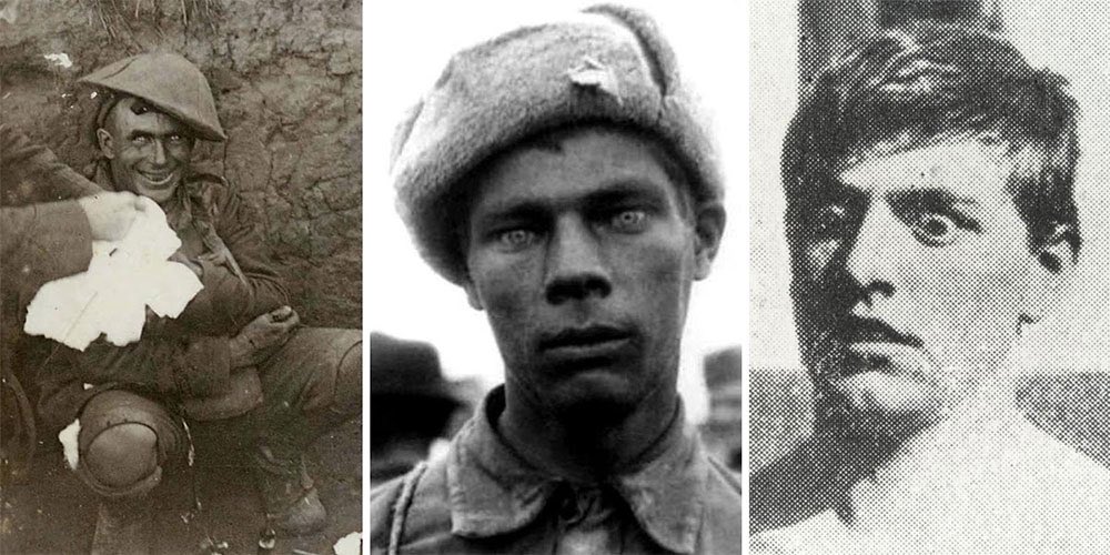 Shell Shock Sendromu, savaş ortamında bulunan kişinin ani değişen ruh haline sahip olması,gerçeklik duygusunda kayıp,şok ve hafıza kaybı, kimlik ve bellek bağlantısının kopması,güvensizlik,donup kalma,tutarsız hareketler ve anlamsız mimikler gösterme durumudur. #SavasaHayir