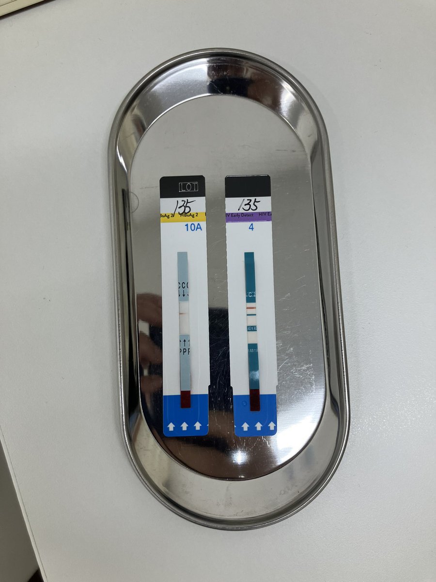 sbskey's tweet photo. bioにしか書いてなかったですが、9月上旬に血液・尿検査を受け問題なしでした。(2枚目は血液検査結果の実物) https://t.co/NxdUjlSQcw