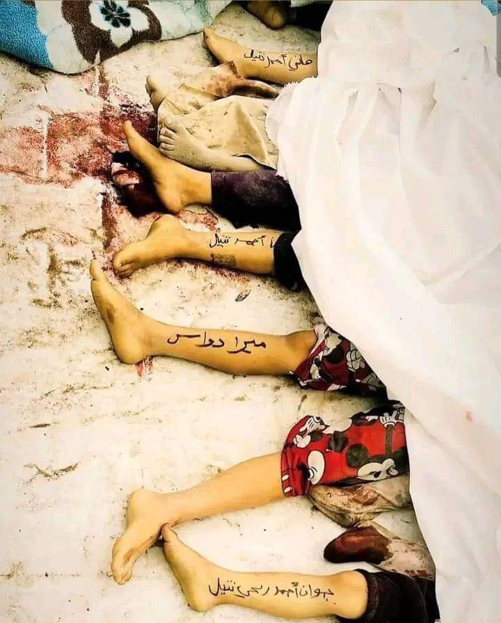 "Gazze’de baba olmak, yazarken teni incinmesin diye sakındığımız evladınızın, buz kesmiş parçalarını toplamakla neticeleniyor..."

😔