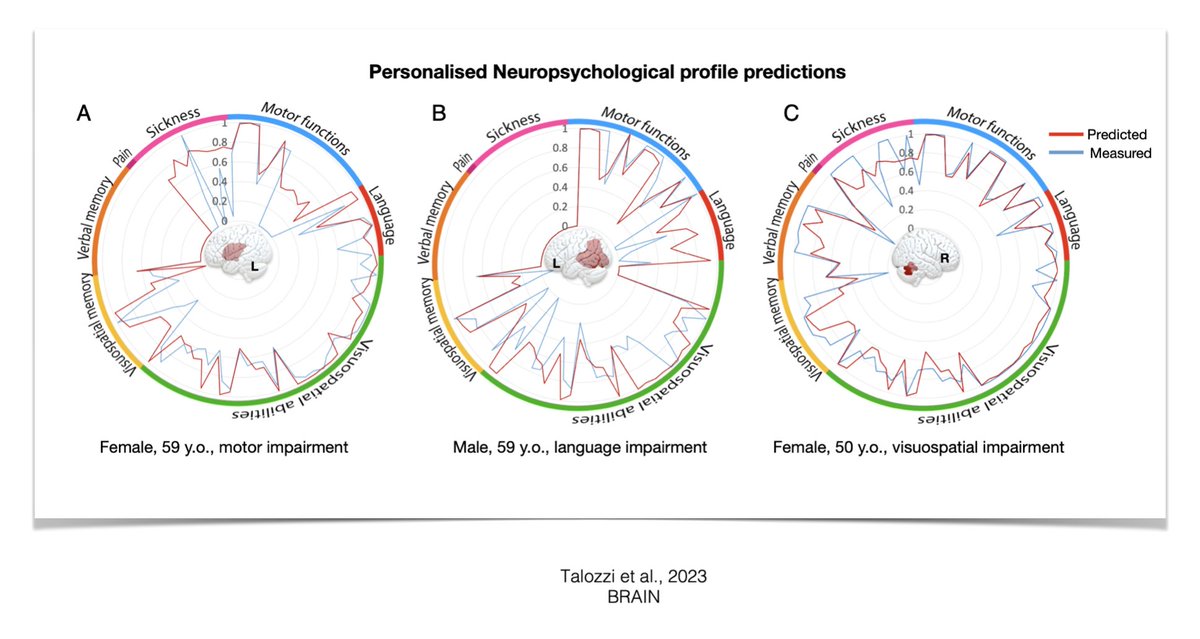 Stephanie Forkel (@stephforkel) on Twitter photo Predicting long-term outcome after #stroke:
An out-of-sample validation in #aphasia from <a href="/PLORASResearch/">PLORAS Research Team</a>: doi.org/10.1093/brain/…
The original model: doi.org/10.1093/brain/…
Predict with your lesion data: disconnectomestudio.bcblab.com
#language #fluency #naming #cognition Predicting long-term outcome after #stroke:
An out-of-sample validation in #aphasia from <a href="/PLORASResearch/">PLORAS Research Team</a>: doi.org/10.1093/brain/…
The original model: doi.org/10.1093/brain/…
Predict with your lesion data: disconnectomestudio.bcblab.com
#language #fluency #naming #cognition