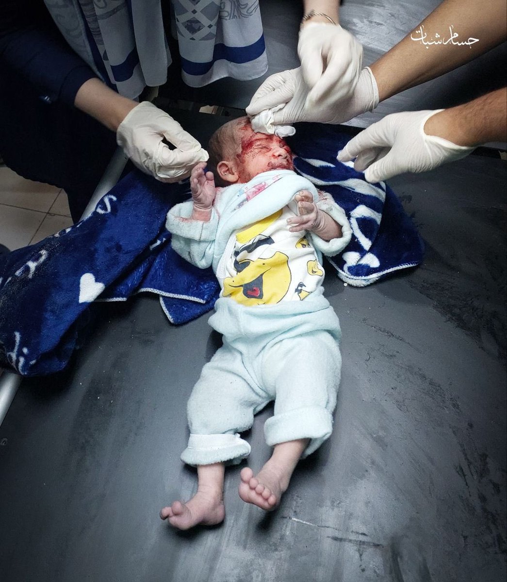 Katil İsrail’in hedef aldığı ufacık bir bebek…

Bebek katili İsrail!

#SaveGazaChildren