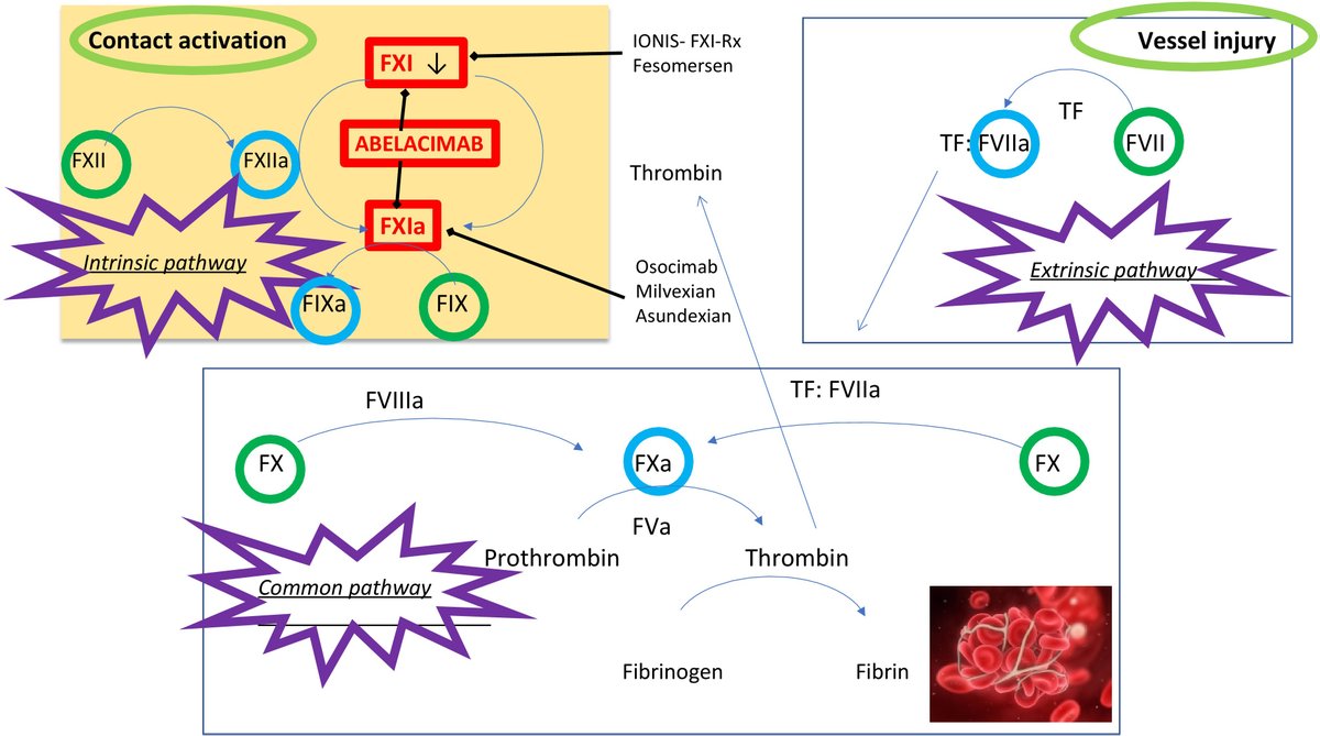 #RCM #cardiovascular Article Share

🌺"Abelacimab in Cancer-Associated Thrombosis: The Right Drug at the Right Time for the Right Purpose. A Comprehensive Review" from Agnese Maria Fioretti, <a href="/PietroScicchi83/">Pietro Scicchitano</a> et al.

#CAT #thrombosis #DOAC #LMWH

🔎Text:
imrpress.com/journal/RCM/24…