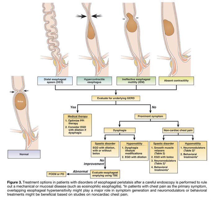 sepdigestiva's tweet photo. Esophageal Motility Disorders: Current Approach to Diagnostics and Therapeutics by @EsophagusDoc

Great review @AGA_Gastro @AmerGastroAssn
 
#GITwitter #MedTwitter 

https://t.co/iaVz0b9wb0 https://t.co/pCh4aMjpnc