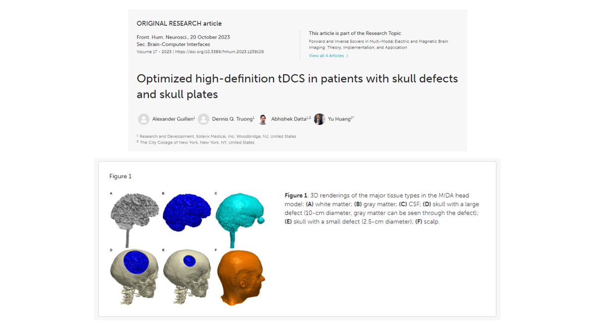 📣New publication from the Soterix Medical R&amp;D team on optimized #HDtDCS in patients with skull defects and plates. Results indicated optimized montages achieved greater stim intensity regardless of defect. Size/type of defect did affect current flow. bit.ly/3rVy73l