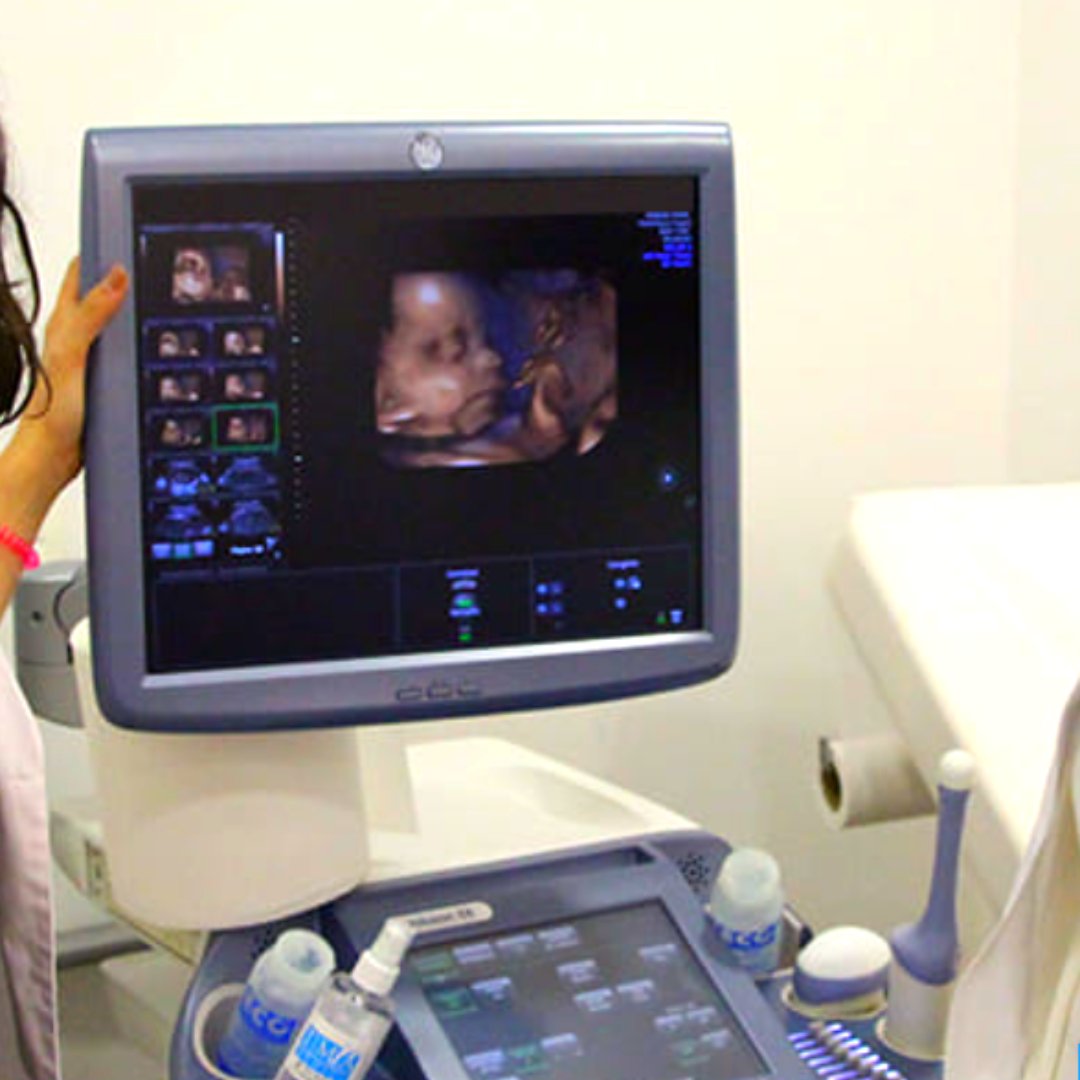 Las nuevas tecnologías permiten que, incluso antes de que el bebé nazca, podamos conocer sus rasgos  👶🏽

Nos sirve para descartar posibles patologías y para que conozcas a tu bebé cuanto antes viendo cómo se mueve, reacciona y gesticula 💞

#obstetriciagranada #embarazoseguro
