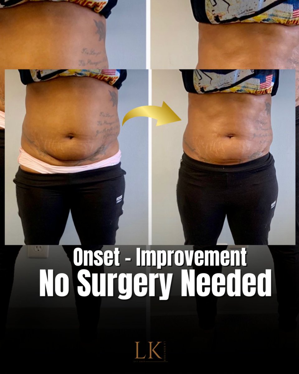 Lakontourbody's tweet image. It&apos;s not just about losing inches; it&apos;s about holistic health. Our services focus on your overall well-being. Ready for a total transformation? 🧘 #HolisticHealth #TotalTransformation
