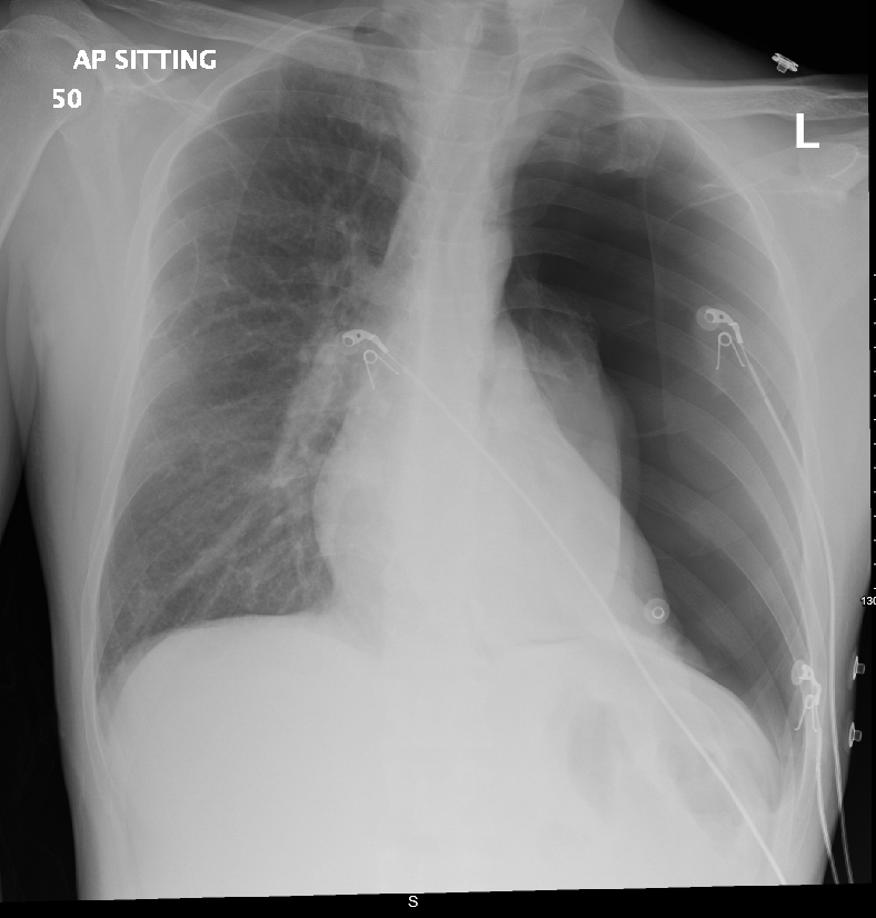 IhabFathiSulima's tweet photo. Severe #SOB.
What is the diagnosis https://t.co/cYLWZBYSUV