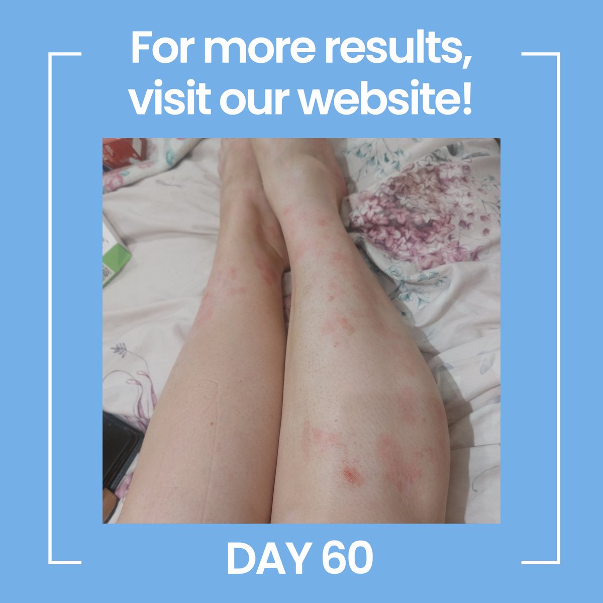 AxisBiotix tweet media