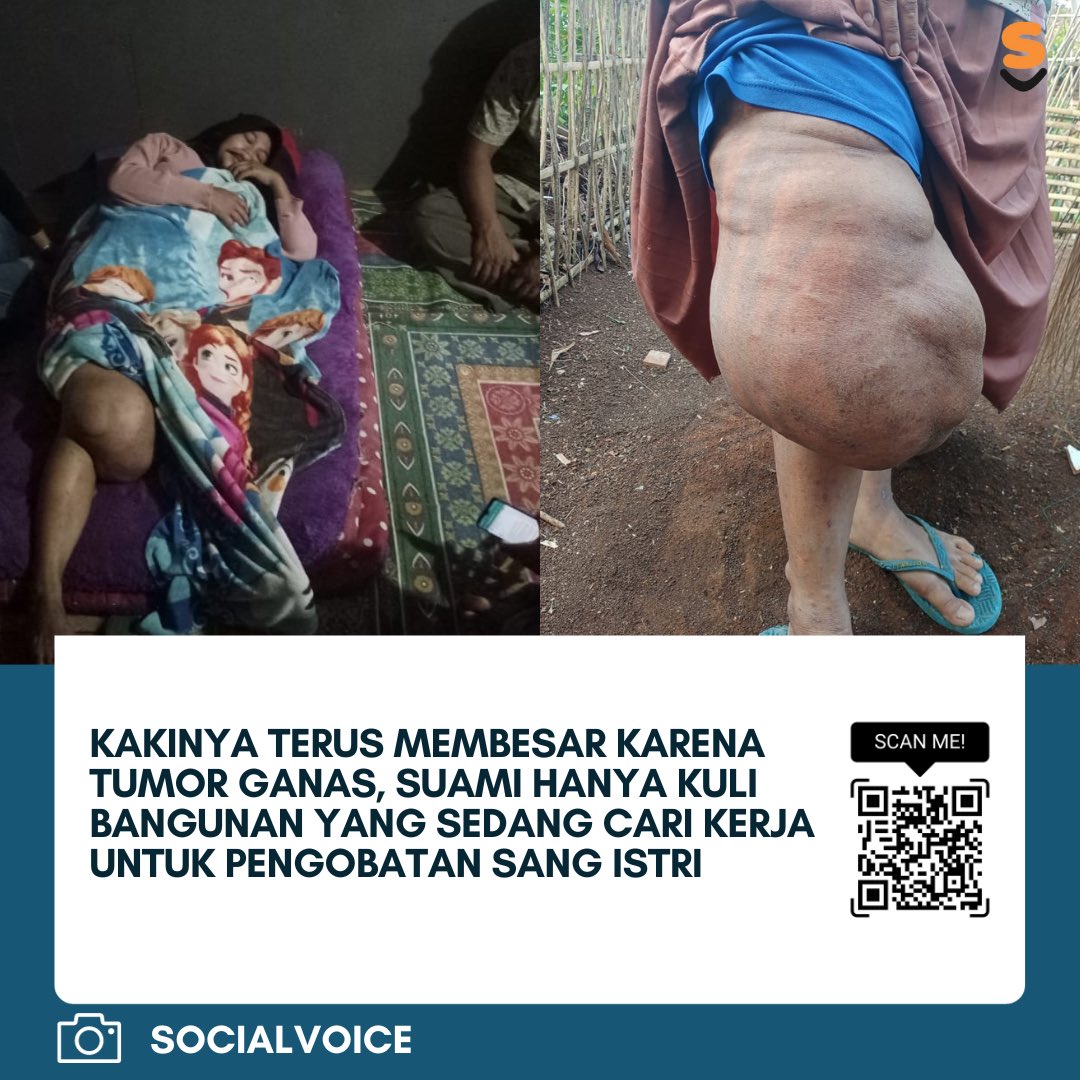 Suaminya hanya kuli bangunan yang jarang ada panggilan. Tak jarang ia menangis karena tak mampu membawa istrinya ke rumah sakit. Kini ia sedang ke luar desa mencari-cari pekerjaan agar bisa membiayai pengobatan istri. 

Bu Siti Aisyah, adalah ibu dua anak yang nyawanya terancam