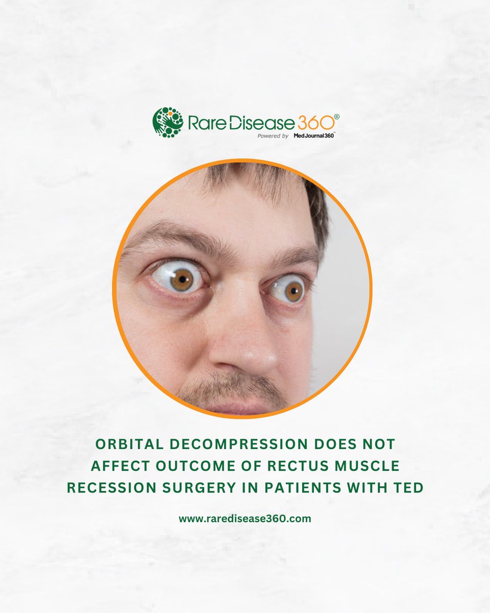 Read the full article here ⤵️
medjournal360.com/thyroid-eye-di…

#raredisease360 #ophthalmology #ophthalmopathy #ocularsurface #diplopia #eyedisease #thyroideyedisease