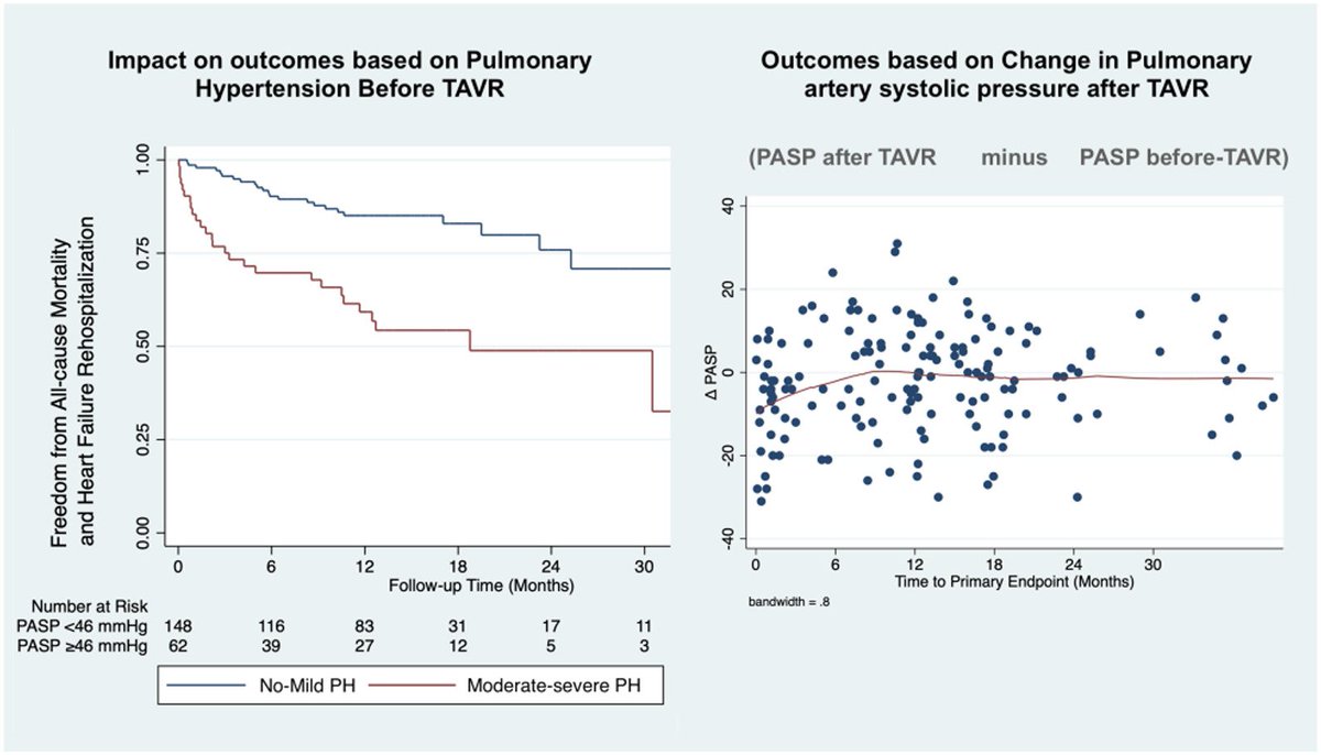 Prof. Hector M. Garcia-Garcia (@hect2701) on Twitter photo #TCT2023
Change in Pulmonary Artery Systolic Pressure After #TAVR
sciencedirect.com/science/articl…
<a href="/CRT_meeting/">CRT Meeting</a> <a href="/news_hart/">Hector Garcia</a> @Shoaib9702 <a href="/jedicath/">jedicath աǟզǟʀ.ǟɦʍɛɖ</a> <a href="/Mustafa_Medical/">Mustafa Alam</a> <a href="/Almanfi_Cardio/">Abdelkader Almanfi, MD, FACC, FSCAI</a> <a href="/KimAtianzar/">Kimberly Atianzar MD FACC FASE</a>
<a href="/BakhshiHooman/">Hooman Bakhshi</a> <a href="/ABeneduceMD/">Alessandro Beneduce</a> <a href="/nyalborgesmd/">Nyal Borges</a> <a href="/aayshacader/">Aaysha Cader</a> <a href="/NishithChandra/">𝔻𝕣 ℕ𝕚𝕤𝕙𝕚𝕥𝕙 ℂ𝕙𝕒𝕟𝕕𝕣𝕒</a> <a href="/baileyannRN/">Bailey Ann Richardson</a> #TCT2023
Change in Pulmonary Artery Systolic Pressure After #TAVR
sciencedirect.com/science/articl…
<a href="/CRT_meeting/">CRT Meeting</a> <a href="/news_hart/">Hector Garcia</a> @Shoaib9702 <a href="/jedicath/">jedicath աǟզǟʀ.ǟɦʍɛɖ</a> <a href="/Mustafa_Medical/">Mustafa Alam</a> <a href="/Almanfi_Cardio/">Abdelkader Almanfi, MD, FACC, FSCAI</a> <a href="/KimAtianzar/">Kimberly Atianzar MD FACC FASE</a>
<a href="/BakhshiHooman/">Hooman Bakhshi</a> <a href="/ABeneduceMD/">Alessandro Beneduce</a> <a href="/nyalborgesmd/">Nyal Borges</a> <a href="/aayshacader/">Aaysha Cader</a> <a href="/NishithChandra/">𝔻𝕣 ℕ𝕚𝕤𝕙𝕚𝕥𝕙 ℂ𝕙𝕒𝕟𝕕𝕣𝕒</a> <a href="/baileyannRN/">Bailey Ann Richardson</a>