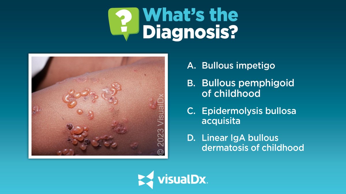 What’s the Dx? 5 yo girl w/ a rash that began 3 weeks prior. The patient was otherwise well & was on no medications. Exam: tense vesicles & bullae, some in arcuate arrays, & secondary crusting were seen on the arms. Tell us your Dx!
