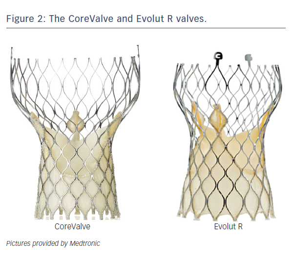 #TCT2023

Reintervention occurred most often at <1 year for #TAVR and at >1 year for #SAVR. The majority of early reinterventions were with first-generation #CoreValve and managed percutaneously. #Evolut R/PRO valves required fewer reinterventions than CoreValve, with rates