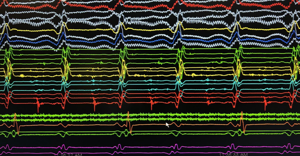 Smit Vasaiwala, MD tweet media