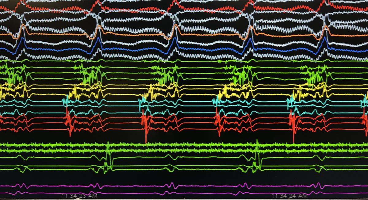 Smit Vasaiwala, MD tweet media