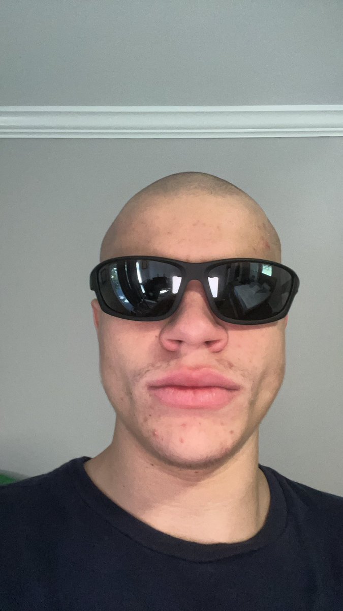 im back bitch 🧑🏻‍🦲