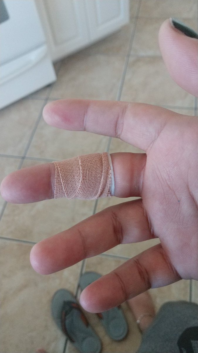 Ace_And_Fluid's tweet photo. Guess who just got bit by a dog for the first time. He tried to take off my fucking finger. I pulled back and he bit harder. I got it wrapped with paper soaked in salt water. I can't bend my finger at all. I'm just glad it wasn't my dominant hand https://t.co/PIPHGSb3iS