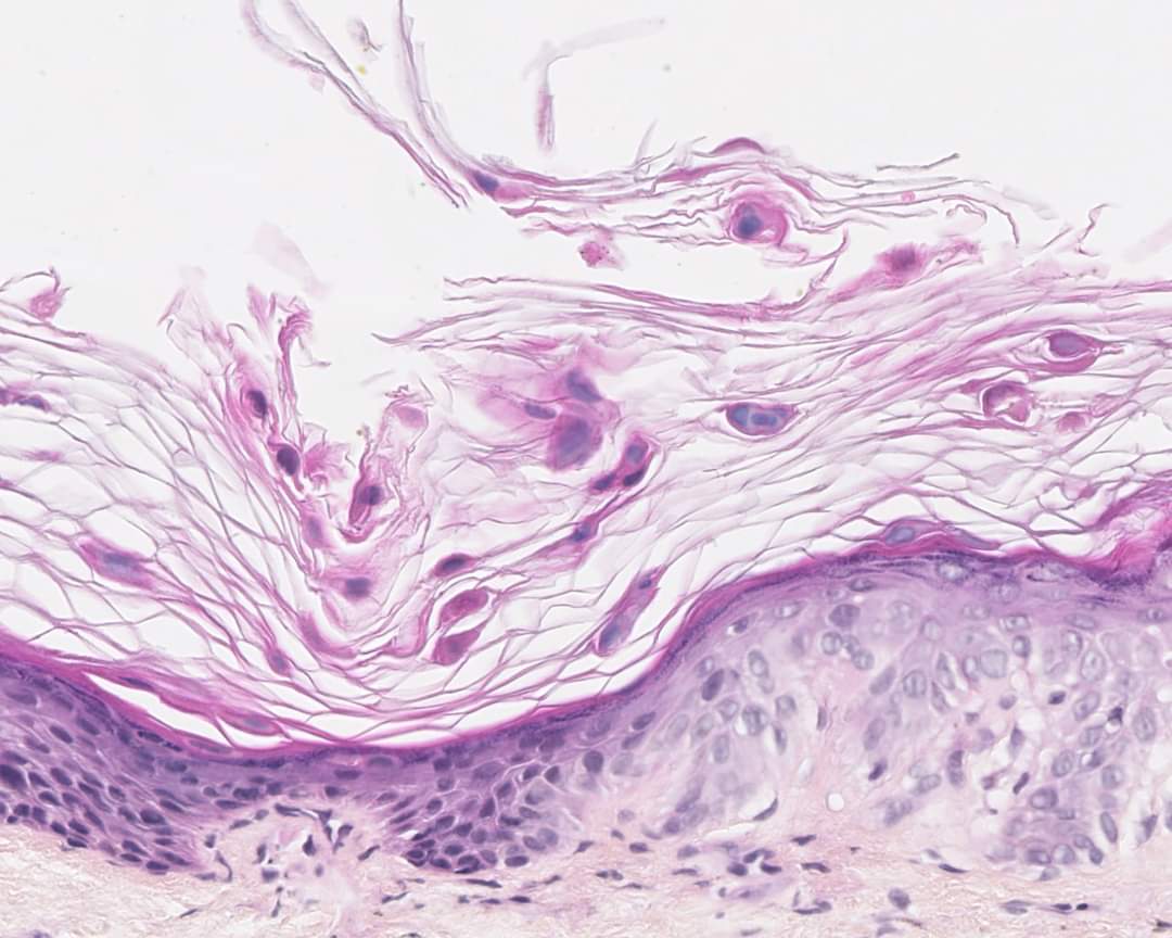Annpathol's tweet photo. 📢 À vous de jouer à présent pour sélectionner la photo que vous jugerez la plus esthétique 🔬📸parmi les 4 ici, jusqu'au 12/11 minuit ⏳:
https://t.co/aQNlbxWy2W
#pathart #pathology #francophonepath https://t.co/D7s1MwHCpN