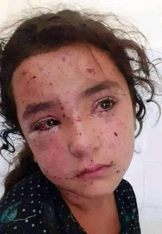 #StopGazaGenocide 
#FreePalaestine 
#SaveGazaCivilians