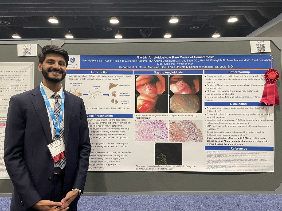 Excited to present at ACG as my first 💩 conference! Honored to win Outstanding Poster Presenter this year🏅Grateful to @ADeshmukhDO and <a href="/JayShahDO/">Jay Shah, DO, MS</a> for the guidance! <a href="/AmCollegeGastro/">ACG</a> <a href="/slusom/">SLU Medicine</a> <a href="/SLUgastro/">SLU Gastroenterology & Hepatology</a> <a href="/im_slu/">SLU Internal Medicine Residency</a> #ACG2023 #GITwitter