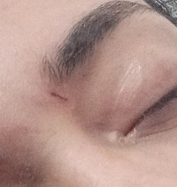 A cachaça de sábado foi tão miserável que eu cortei a cara quando tirei o óculos KKKKKKKKKKKKKK